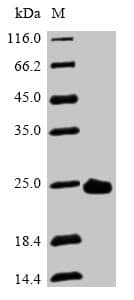 Human PRDX2 / Peroxiredoxin 2 Protein (Recombinant 6His, N-terminus)