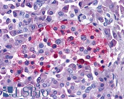PathPlus™ Polyclonal Rabbit anti-Human GLP1R / GLP-1 Receptor Antibody (N-Terminus, IHC, IF, WB)