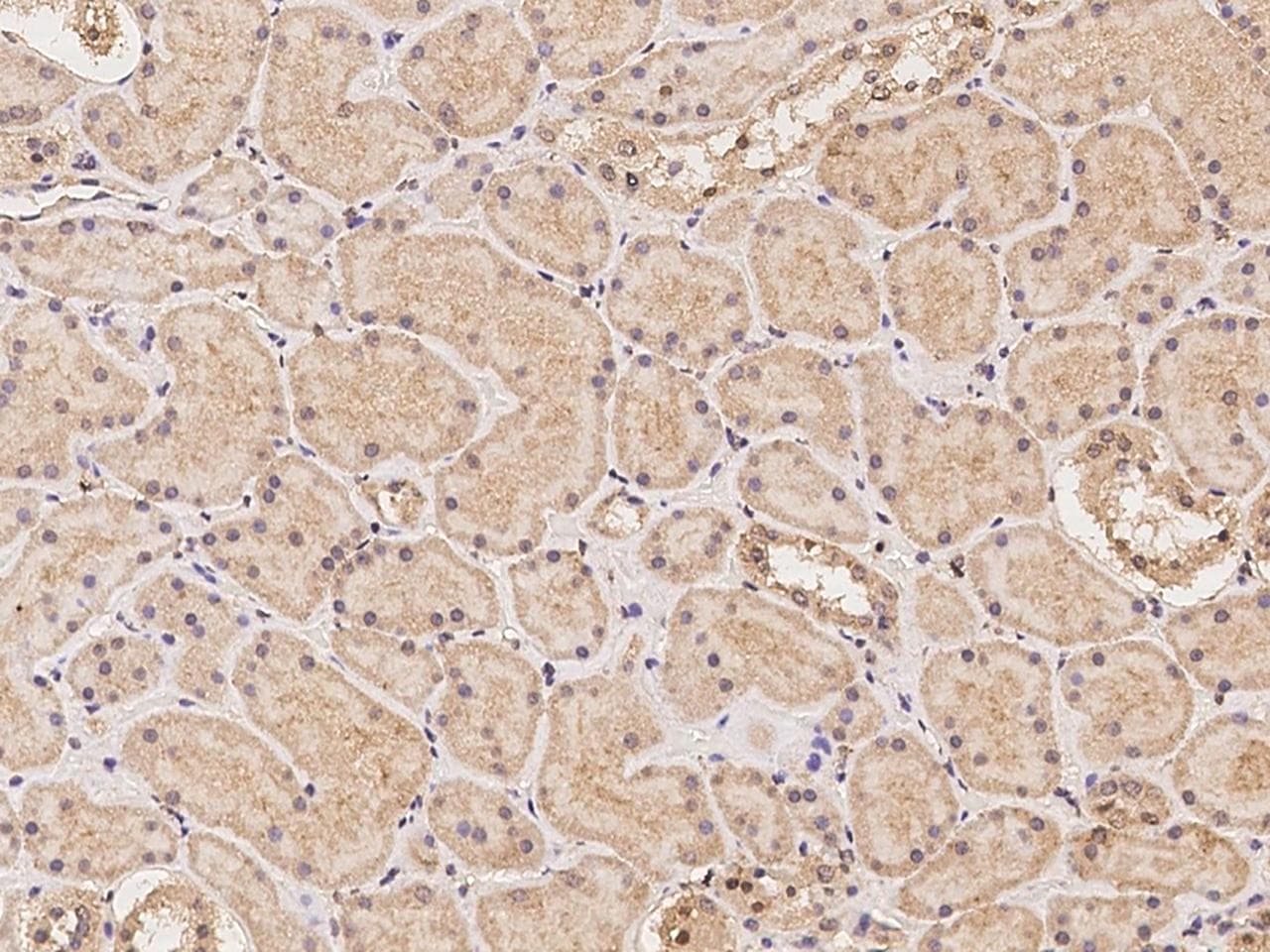 Polyclonal Rabbit anti-Human MMP13 Antibody (IHC)