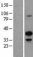 Human MAFB Protein (Over-Expression Lysate Myc-DDK (Flag))