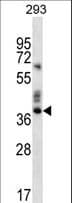 OR9K2 Antibody (aa301-330)