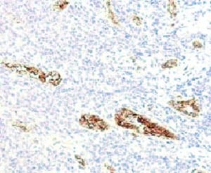 VWF / Von Willebrand Factor Antibody (clone WFA52-2)