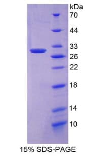 Mouse APP / Beta Amyloid Precursor Protein (Recombinant His)
