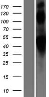 Human ADRB2 Protein (Over-Expression Lysate Myc-DDK (Flag))