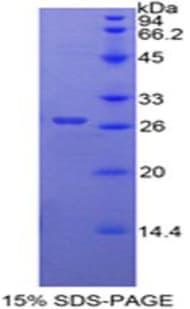 Human FZD1 / Frizzled 1 Protein (Recombinant His-T7)