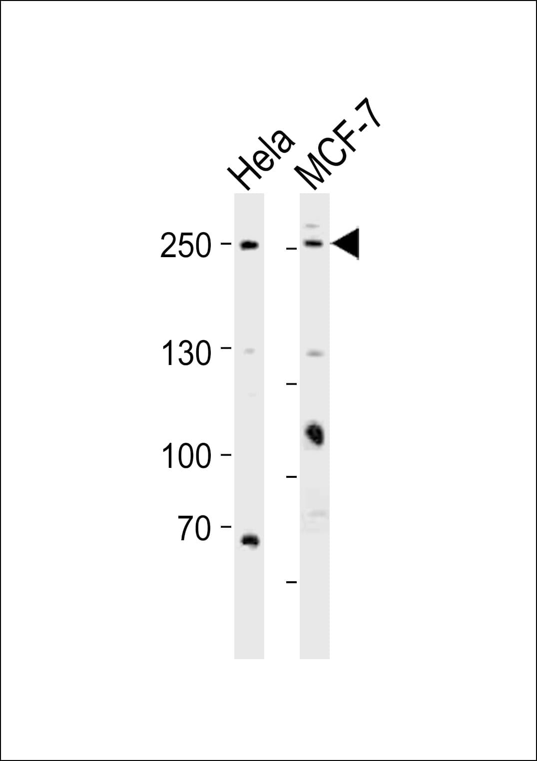 MUC4 Antibody (aa529-560)