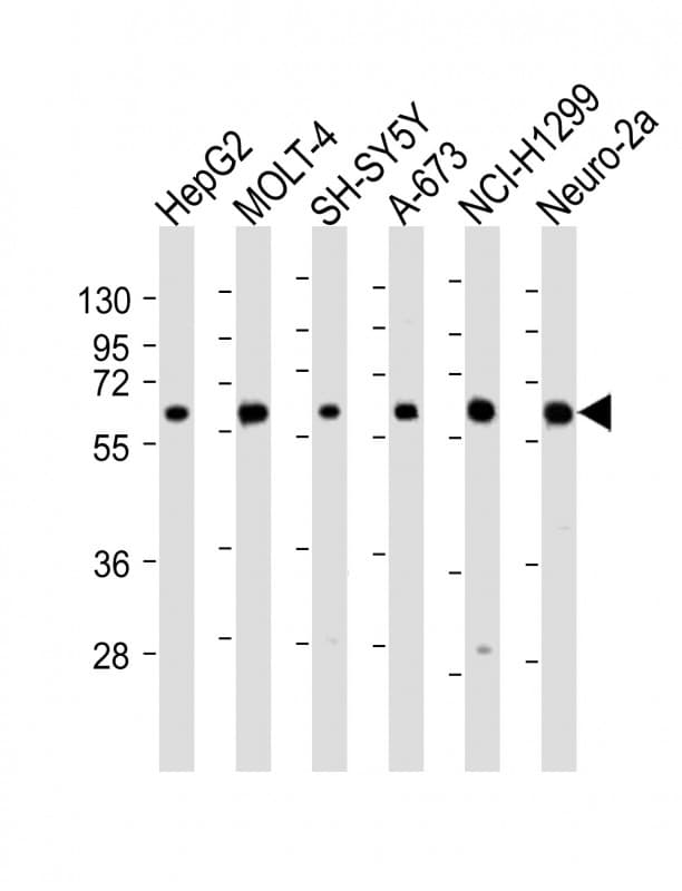 CHRNA4 / NACHR Antibody (aa176-208)