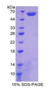 Human AGRN / Agrin Protein (Recombinant 6His, N-terminus)