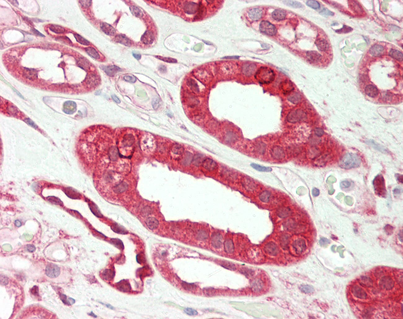 Polyclonal Rabbit anti-Human SERPINE1 / PAI-1 Antibody (aa201-250, IHC, WB)