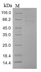 Human CILP Protein (Recombinant 10His, N-terminus + Myc, C-terminus)