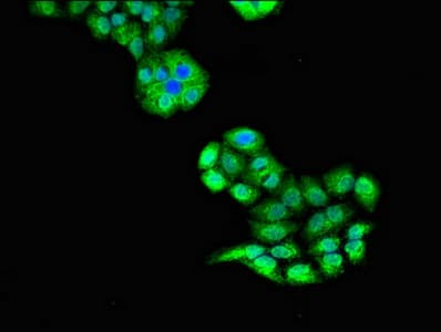 Polyclonal Rabbit anti-Human ULK1 Antibody (IF)