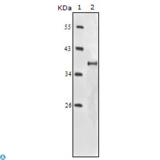 IGF1R / IGF1 Receptor Antibody