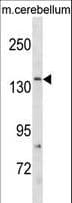 Polyclonal Rabbit anti-Human GRIN2C / NMDAR2C / NR2C Antibody (aa567-595, WB)
