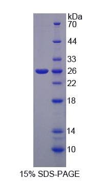 Human NFAT1 / NFATC2 Protein (Recombinant His-S)