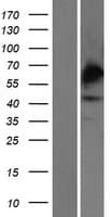 CHST4 / GlcNAc6ST2 Protein (Over-Expression Lysate Myc-DDK (Flag))