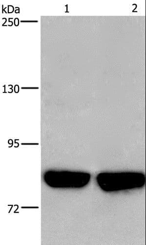 Polyclonal Rabbit anti-Human PFKP Antibody (IHC, WB)