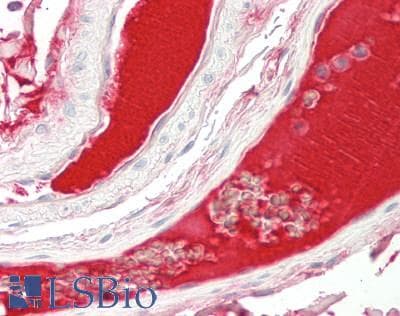 IHC-plus™ RSPO3 Antibody (aa22-272, clone 3D5)