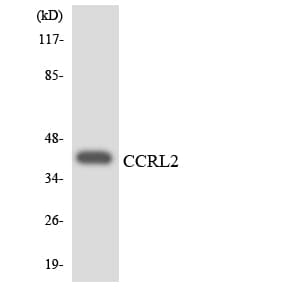 CCRL2 Antibody (aa132-181)