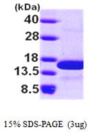 Human NHP2L1 Protein (Recombinant His)