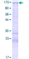 Human HDAC4 Protein (Recombinant GST)