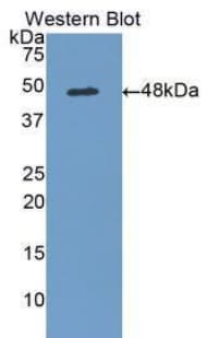 ADIPOR1/Adiponectin Receptor 1 Antibody (aa1-136, FITC)