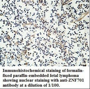 ZNF701 Antibody (aa1-291)