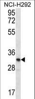 OR51L1 Antibody (aa1-30)
