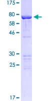 Human KRT15 / CK15 / Cytokeratin 15 Protein (Recombinant GST)