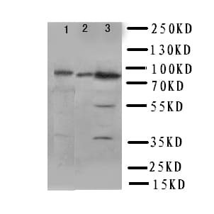 PIK3R2 / p85 Beta Antibody (aa447-461)