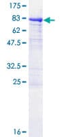Human P4HA1 Protein (Recombinant GST)