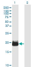 Monoclonal Mouse anti-Human IFT20 Antibody (clone 3F3, WB)