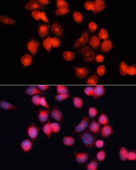 ANT2 / SLC25A5 Antibody