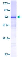 Human MTUS1 Protein (Recombinant GST)