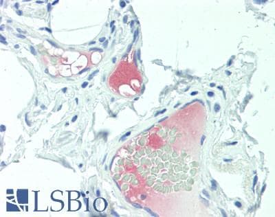 LRG1 / LRG Antibody (aa37-340)