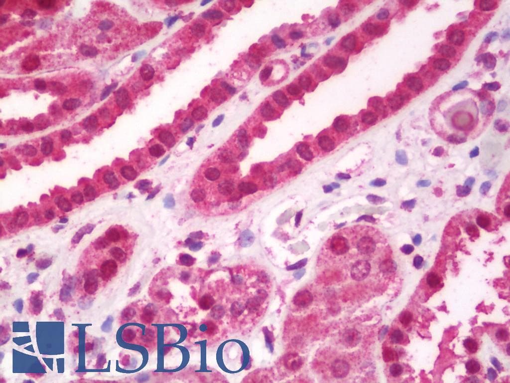 IHC-plus™ BSAC / MKL1 Antibody (aa700-750)