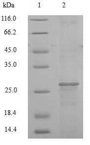 Human F3 / CD142 / Tissue factor Protein (Recombinant 6His-SUMO, N-terminus)