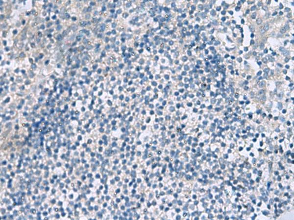 Polyclonal Rabbit anti-Human HPCAL1 / Hippocalcin-Like 1 Antibody (IHC, WB)