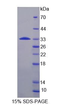 Human RPS6KB1 / P70S6K / S6K Protein (Recombinant His-S)