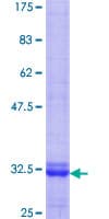 Human SIPR3 / EDG3 / S1P3 Protein (Recombinant GST, N-terminus)