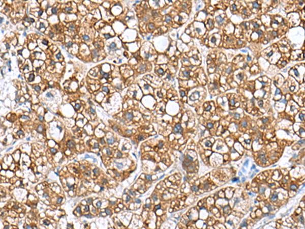 Polyclonal Rabbit anti-Human PHLDA3 Antibody (IHC)