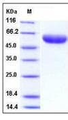 Mouse IL6R / IL6 Receptor Protein (Recombinant His,C-terminus)
