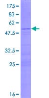 Human RPS8 / Ribosomal Protein S8 (Recombinant GST)