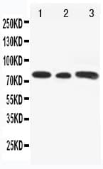Polyclonal Rabbit anti-Human GLI3 Antibody (aa40-57, WB)