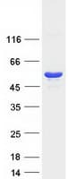 Human PRKAR1A Protein (Recombinant Myc-DDK (Flag))