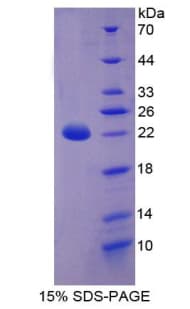 Pig KRT18 / CK18 / Cytokeratin 18 Protein (Recombinant His-T7)