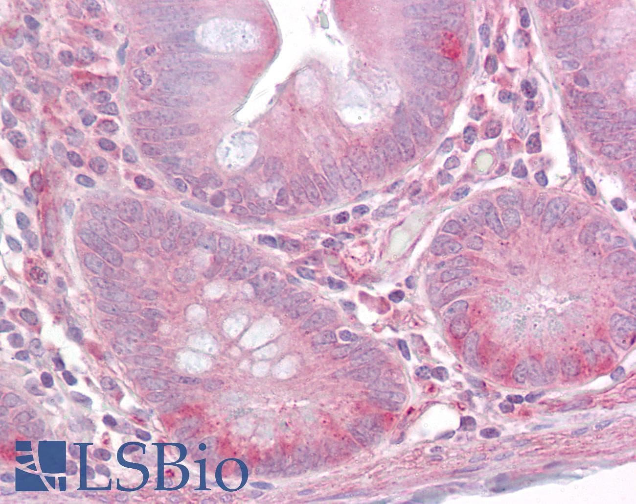 IHC-plus™ Polyclonal Rabbit anti-Human TLR1 Antibody (aa400-450, IHC, WB)