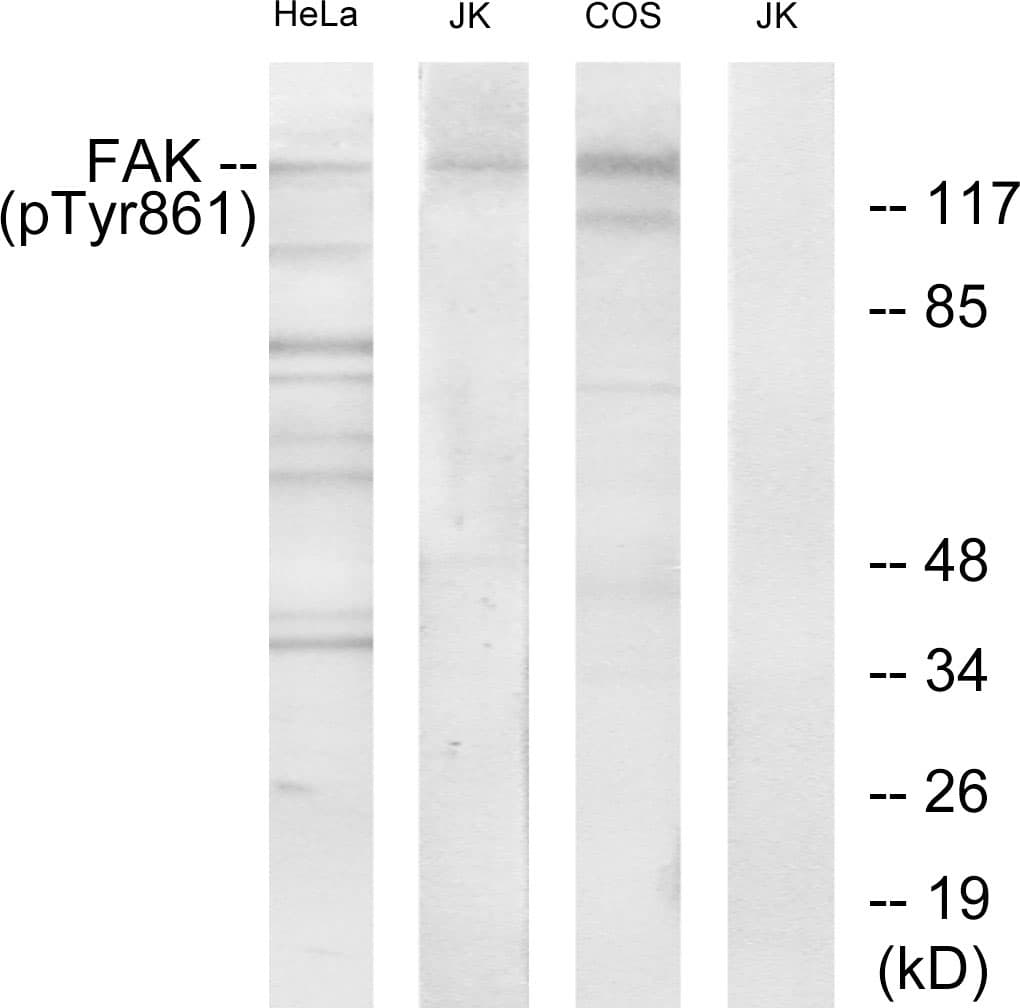 FAK / Focal Adhesion Kinase Antibody (phospho-Tyr861)
