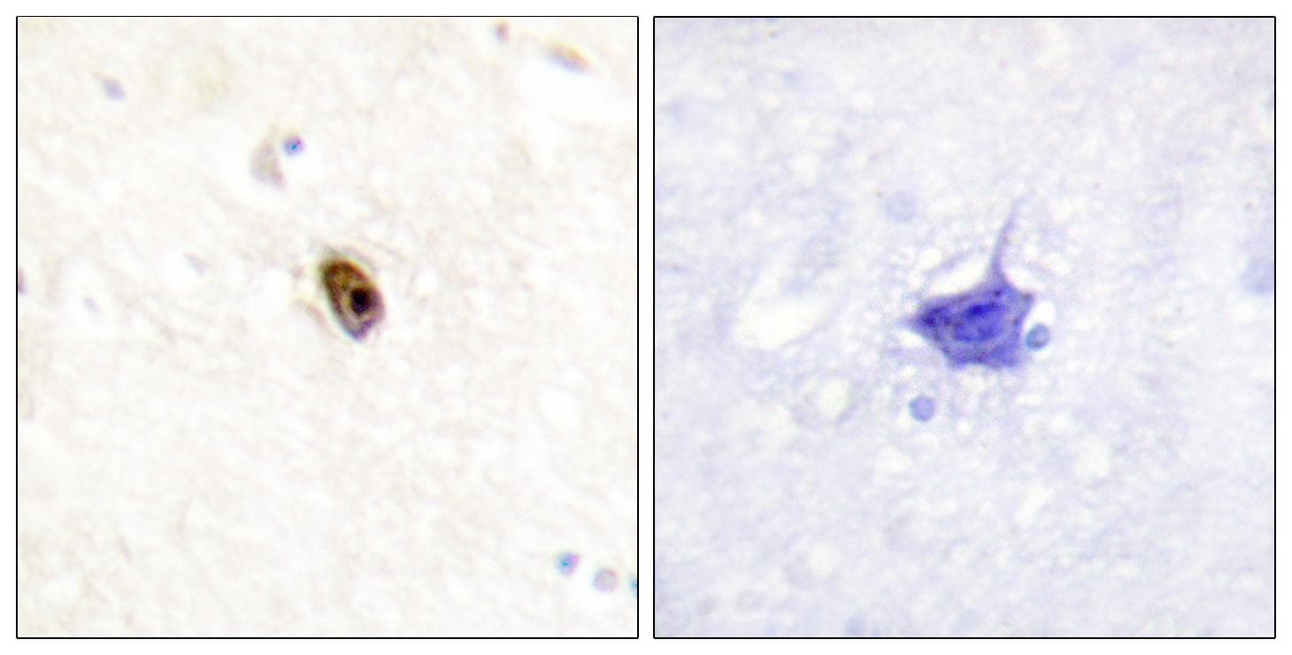 Aurora Kinase B+C Antibody (phospho-Thr236/202)