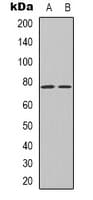 TF / Transferrin Antibody (C-Terminus)