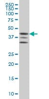 MAPKAPK2 / MAPKAP Kinase 2 Antibody (clone 2B3)
